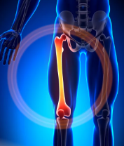  Denuncia subito Risarcimento danni da sinistri stradali a Trapani 